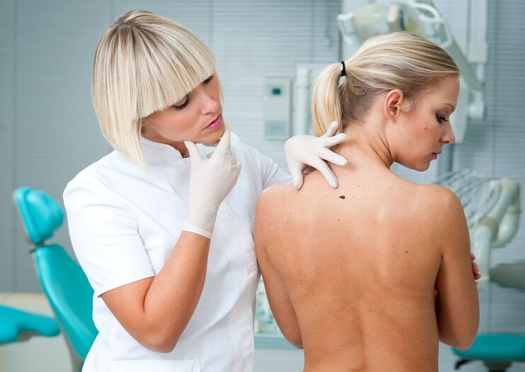 Doctor checking acne on back