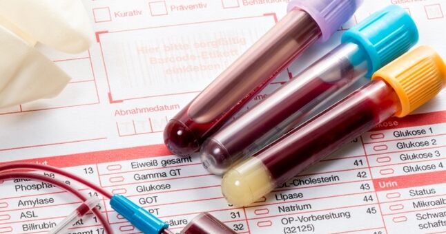 Blood test for human papilloma virus
