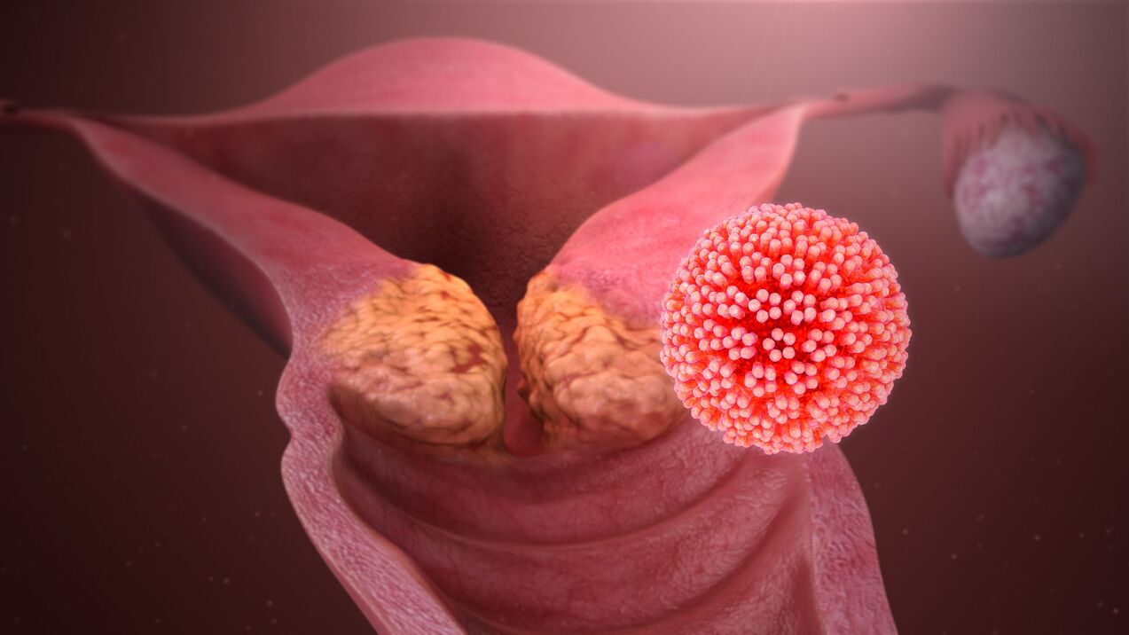 human papilloma virus in the body
